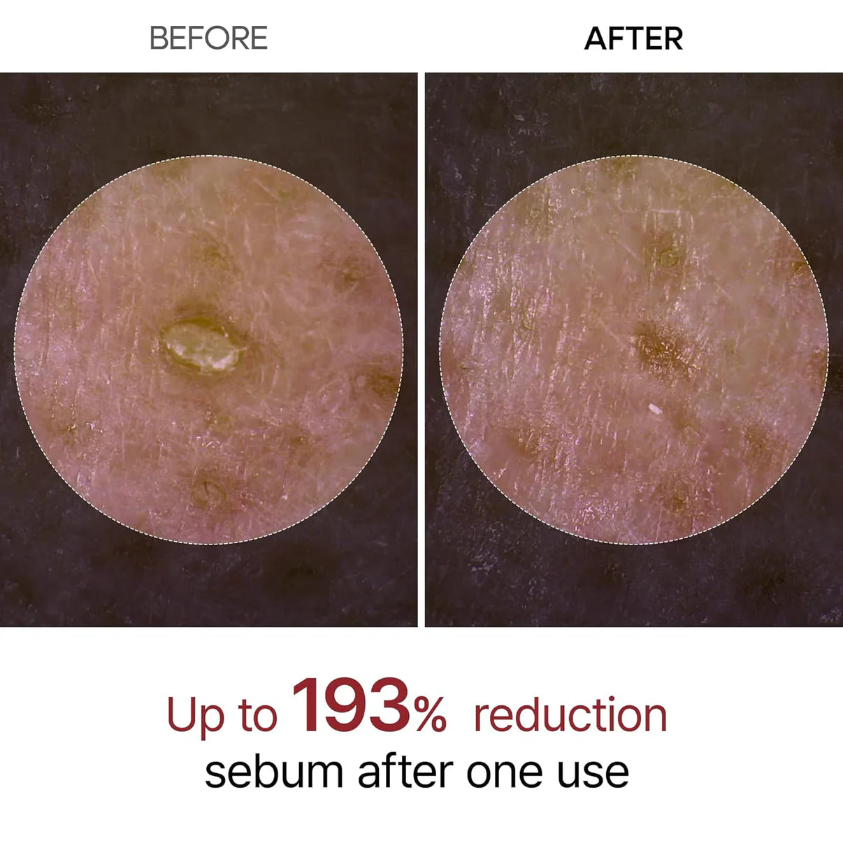 Eloura Rice Peel Serum Ampoule™