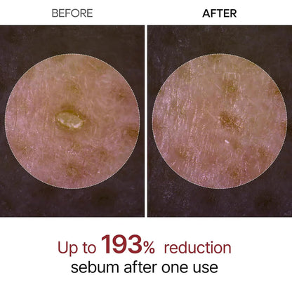 Eloura Rice Peel Serum Ampoule™